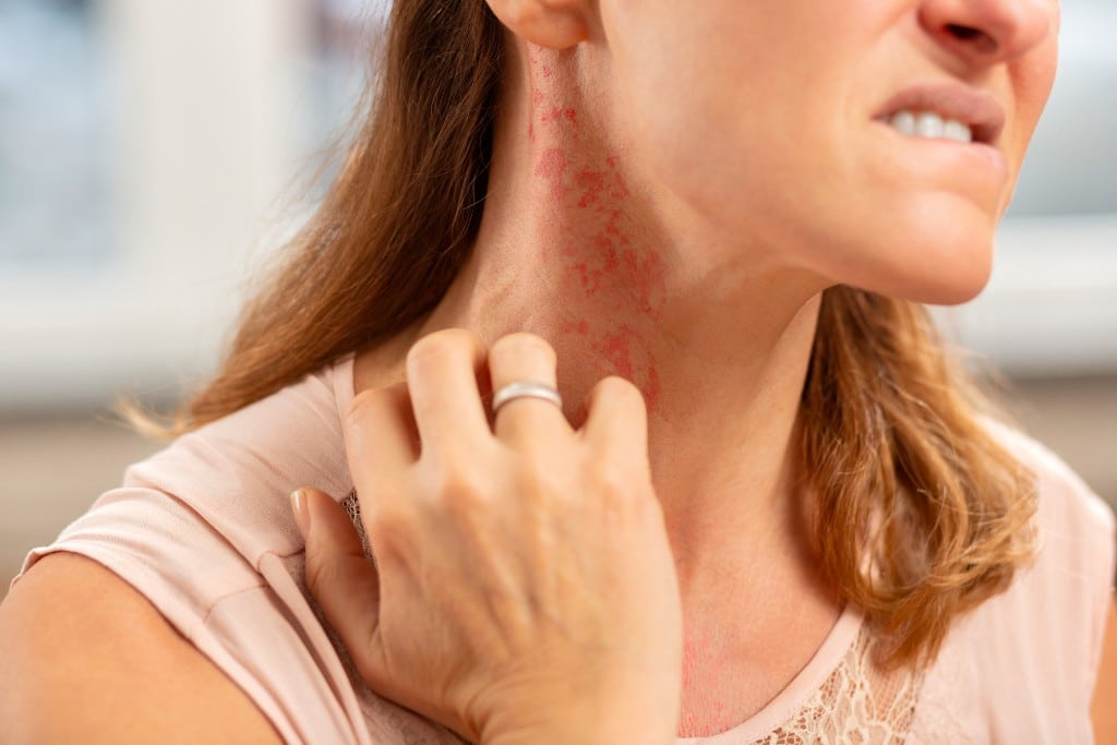 10 Symptoms Of Poor Air Quality In Your Home 3 Allergic Reaction