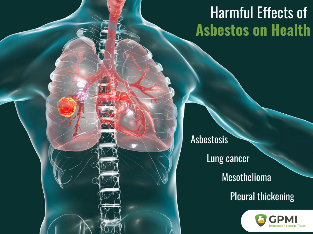 Asbestos Alert In Orange County: Ensuring Safety Amidst Tustin'S Hangar Fire Aftermath 3 Asbestos Health Effects